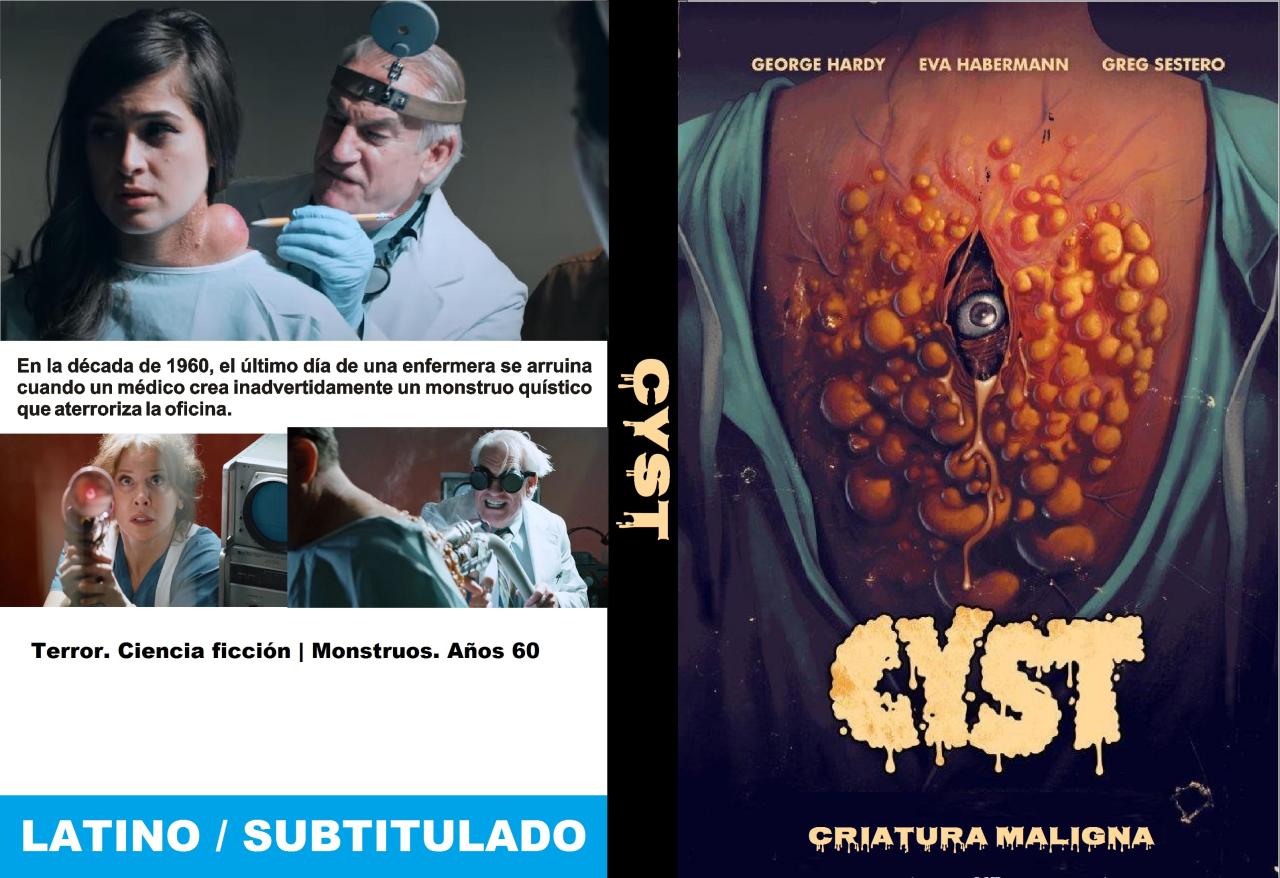 Cyst