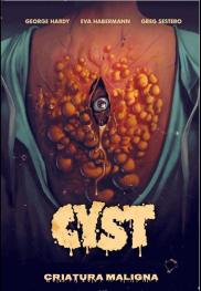Cyst